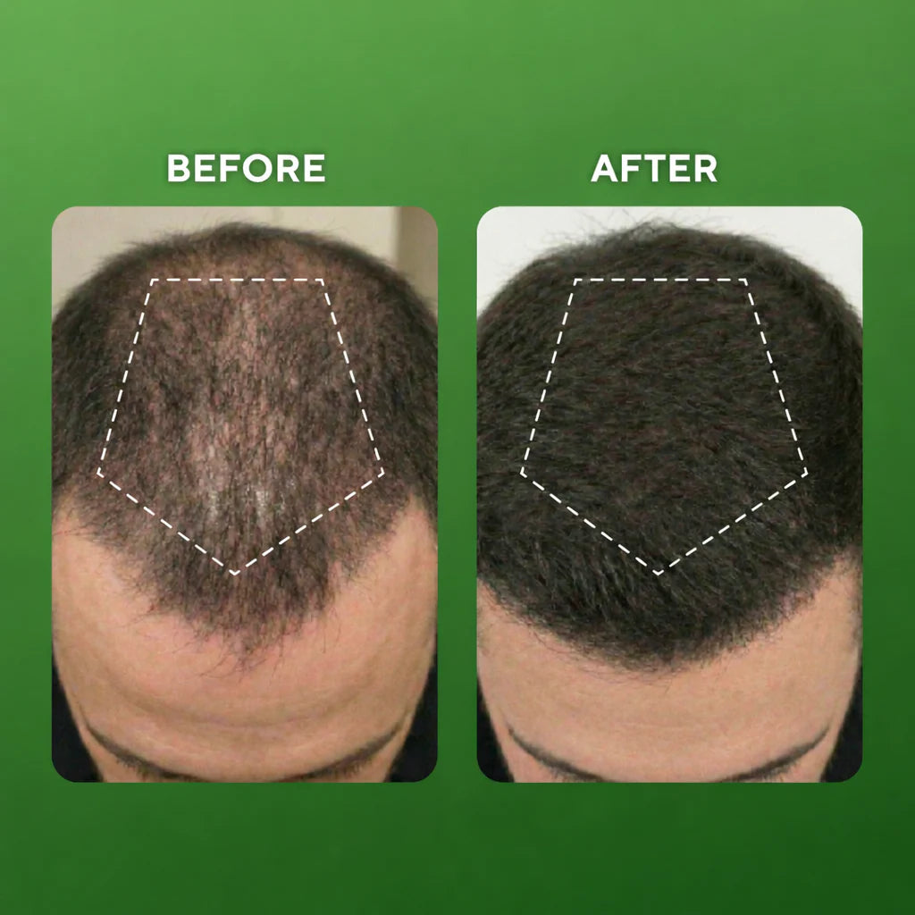 Bionplex Hair Growth Serum